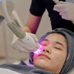 Perawatan Wajah Menggunakan Canggihnya Laser Modern