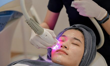 Perawatan Wajah Menggunakan Canggihnya Laser Modern
